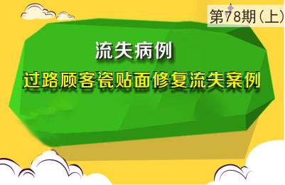 过路顾客瓷贴面修复流失案例