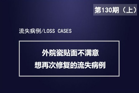 在外院做4D树脂贴面后不满意效果想再次修复的流失病例