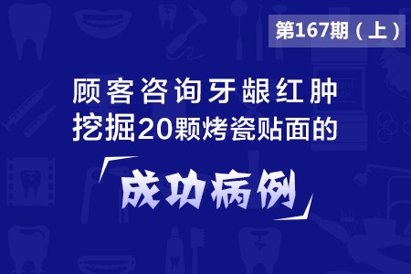 顾客咨询牙龈红肿，挖掘20颗烤瓷贴面的成功病例