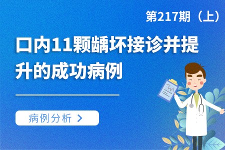 口内11颗龋坏接诊并提升的成功病例